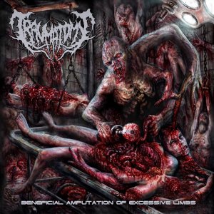 Traumatomy - Beneficial Amputation Of Excessive Limbs (EP) [2014]